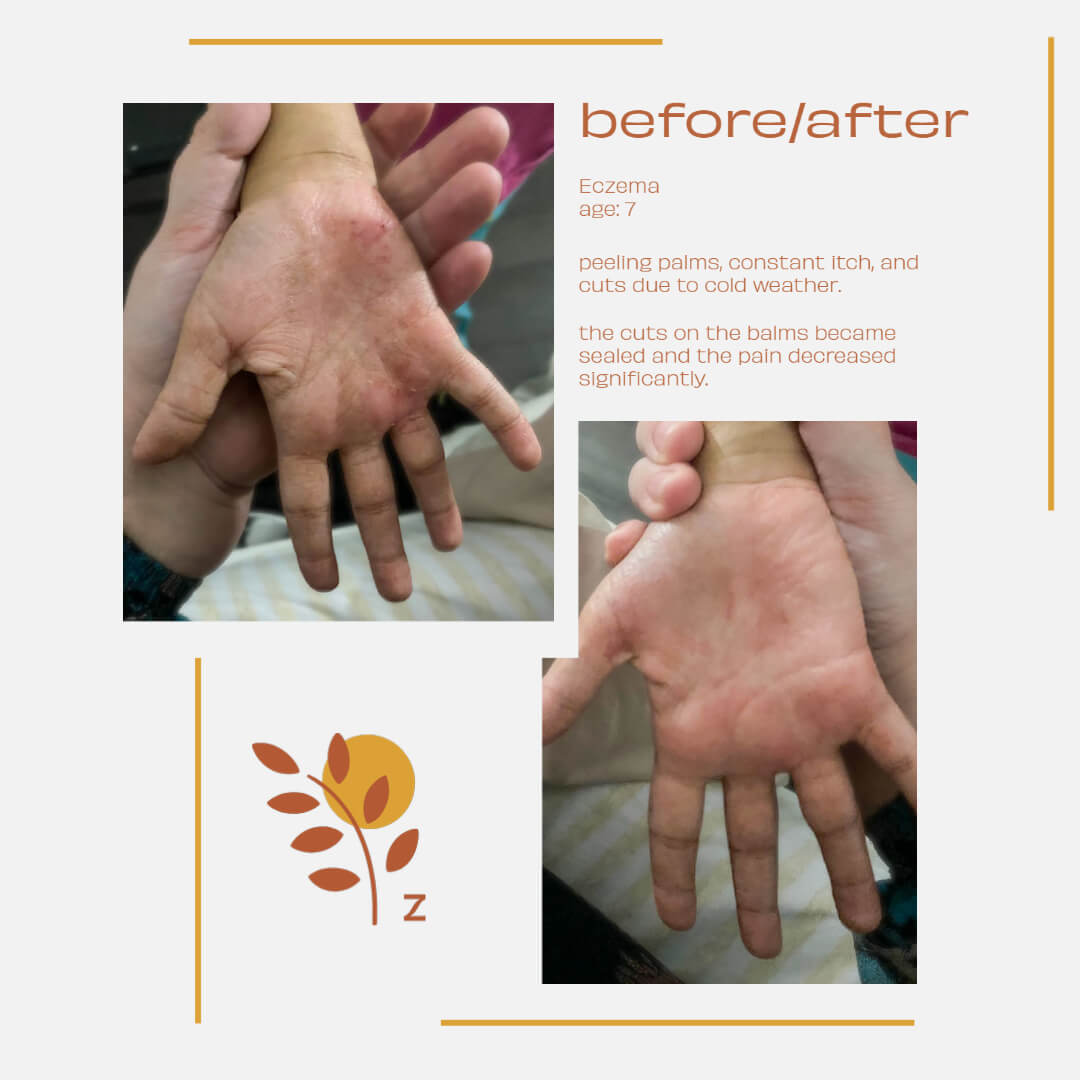 Ziziphus Concentrated Cream Refill Bundle (500ml) image 5