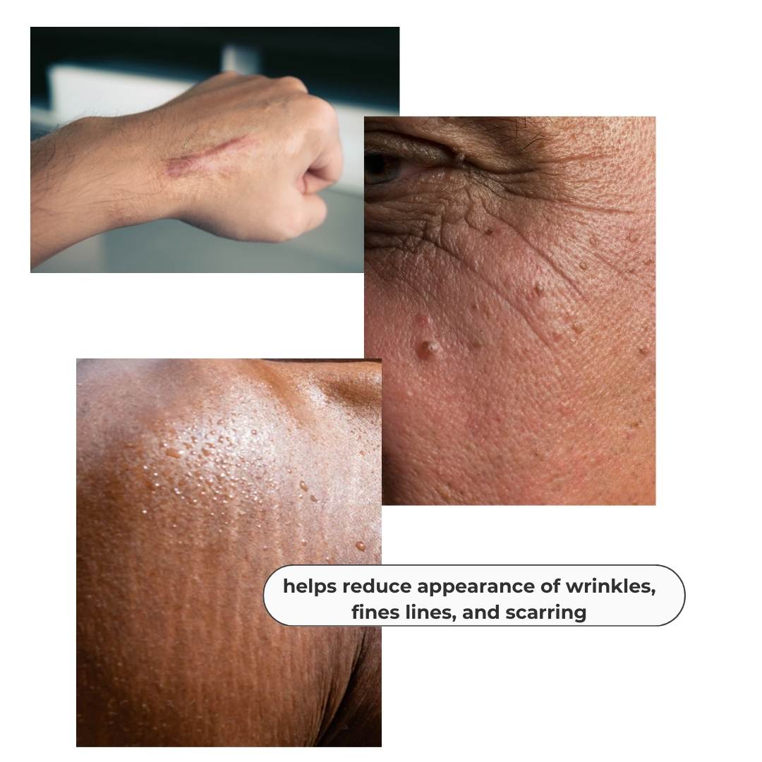 Cacay Scar Serum image 1