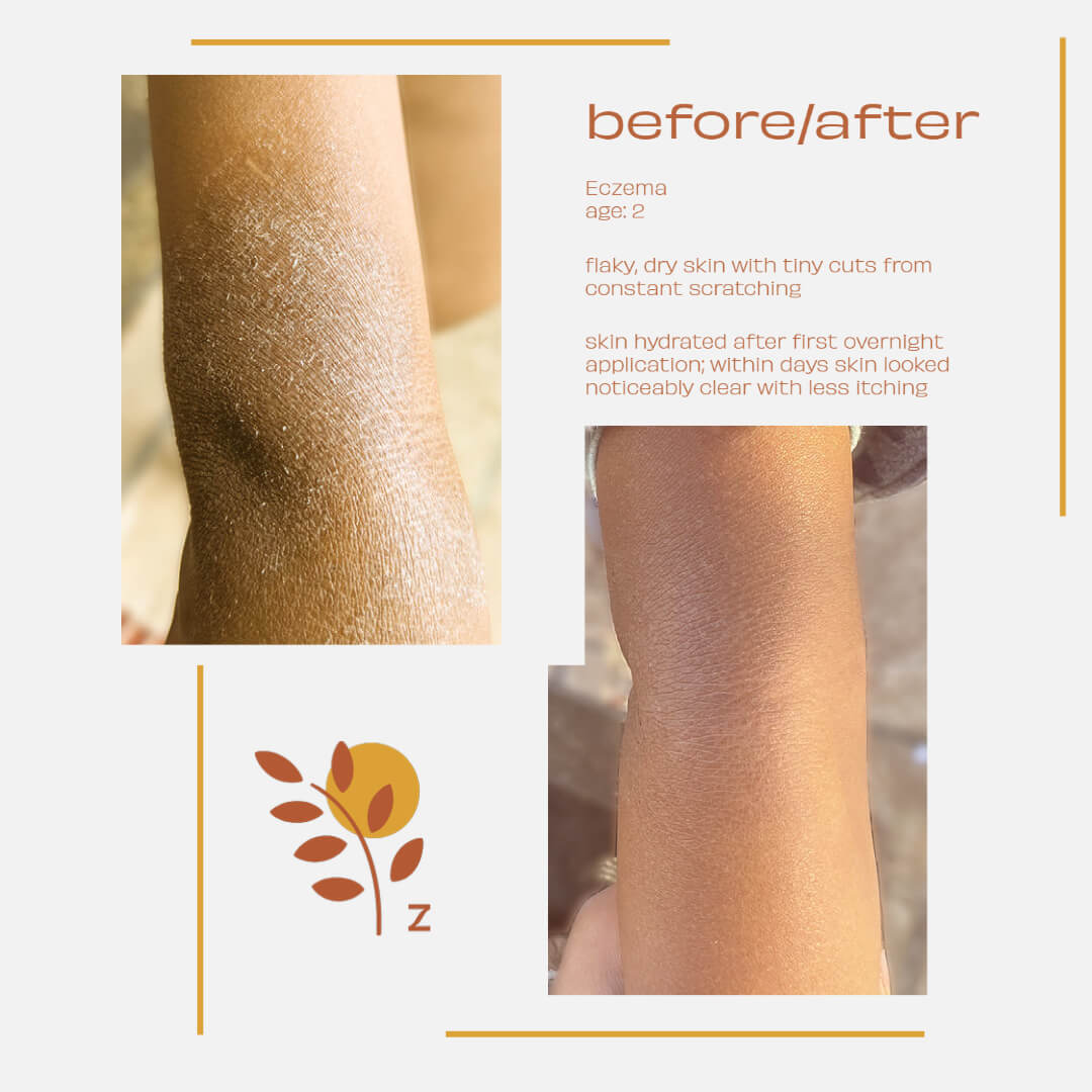 Ziziphus Concentrated Cream image 4