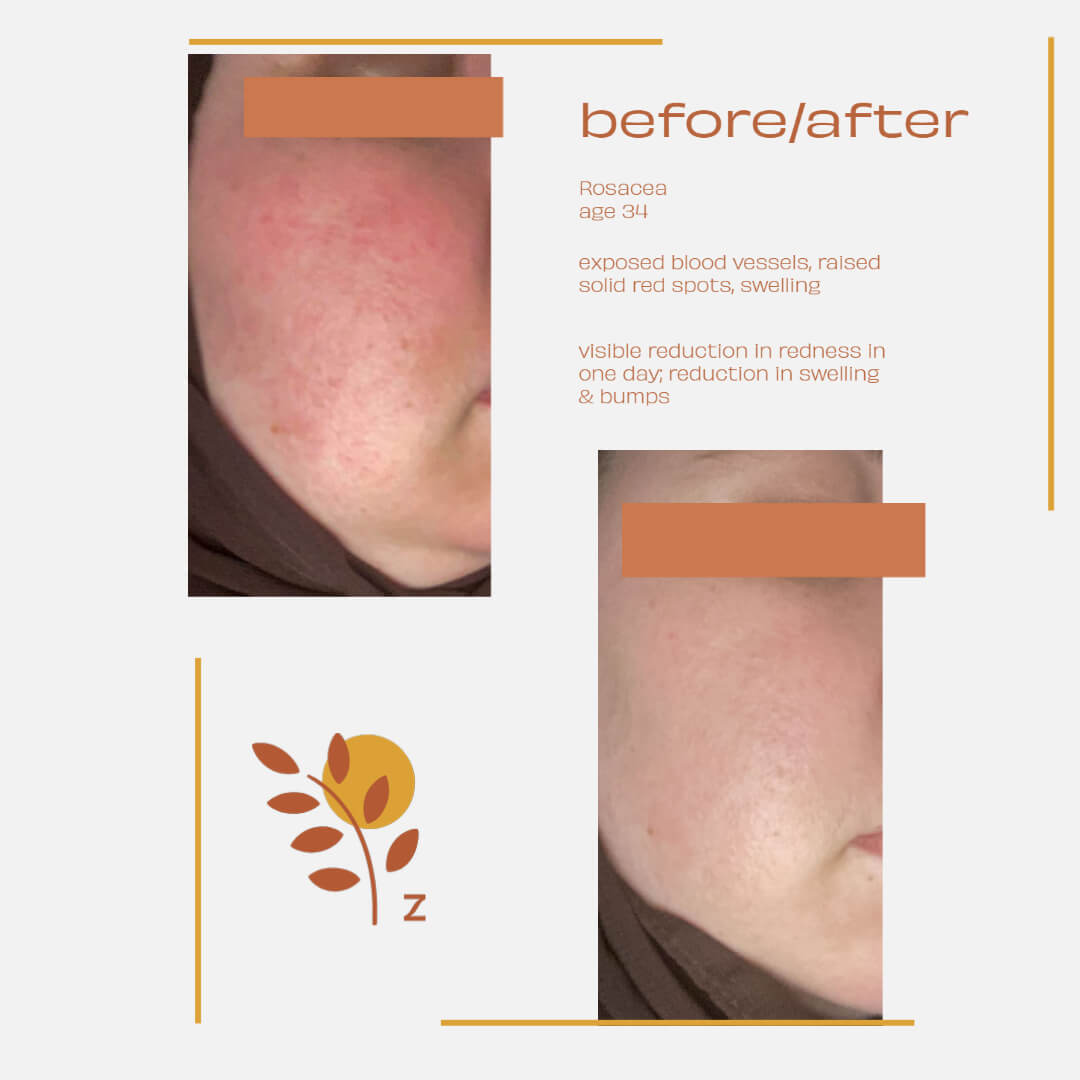 Ziziphus Concentrated Cream image 6