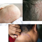 Eczema Scalp Shampoo image 1